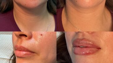 The Anti-Aging Philosophy of Eternia Medspa