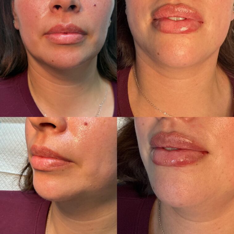 The Anti-Aging Philosophy of Eternia Medspa